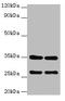 B Cell Receptor Associated Protein 31 antibody, A51753-100, Epigentek, Western Blot image 