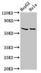 Mitochondrially Encoded NADH:Ubiquinone Oxidoreductase Core Subunit 5 antibody, LS-C670764, Lifespan Biosciences, Western Blot image 