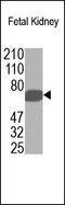 MYCN Proto-Oncogene, BHLH Transcription Factor antibody, 251912, Abbiotec, Western Blot image 