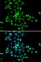 SBDS Ribosome Maturation Factor antibody, orb373294, Biorbyt, Immunocytochemistry image 
