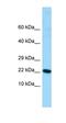 ALG13 UDP-N-Acetylglucosaminyltransferase Subunit antibody, orb325424, Biorbyt, Western Blot image 