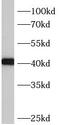 Bardet-Biedl Syndrome 5 antibody, FNab00819, FineTest, Western Blot image 