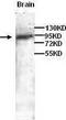 Clock Circadian Regulator antibody, TA310045, Origene, Western Blot image 