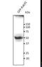 RAB35, Member RAS Oncogene Family antibody, LS-C348302, Lifespan Biosciences, Western Blot image 
