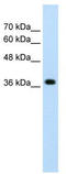 LON Peptidase N-Terminal Domain And Ring Finger 1 antibody, TA330507, Origene, Western Blot image 