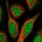 Spermatogenesis Associated 24 antibody, HPA044000, Atlas Antibodies, Immunofluorescence image 