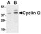 Cyclin O antibody, LS-C19613, Lifespan Biosciences, Western Blot image 