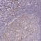 Zinc Finger And BTB Domain Containing 6 antibody, HPA054111, Atlas Antibodies, Immunohistochemistry paraffin image 