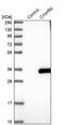 Chromosome X Open Reading Frame 56 antibody, NBP1-82097, Novus Biologicals, Western Blot image 
