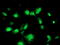 Phosphomevalonate Kinase antibody, M10103, Boster Biological Technology, Immunofluorescence image 