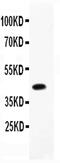 CCAAT Enhancer Binding Protein Beta antibody, PA5-79030, Invitrogen Antibodies, Western Blot image 