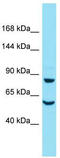 Dishevelled Associated Activator Of Morphogenesis 2 antibody, TA338346, Origene, Western Blot image 