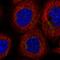 Dymeclin antibody, HPA049187, Atlas Antibodies, Immunocytochemistry image 