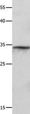 ETS Proto-Oncogene 1, Transcription Factor antibody, TA323910, Origene, Western Blot image 
