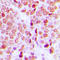 ETS2 Repressor Factor antibody, LS-C358748, Lifespan Biosciences, Immunohistochemistry paraffin image 