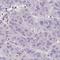 Extracellular sulfatase Sulf-1 antibody, NBP2-31584, Novus Biologicals, Immunohistochemistry frozen image 