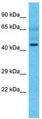 Mitochondrial tRNA-specific 2-thiouridylase 1 antibody, TA346791, Origene, Western Blot image 