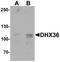 Probable ATP-dependent RNA helicase DHX36 antibody, TA320129, Origene, Western Blot image 