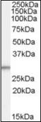 TPD52 Like 2 antibody, orb94106, Biorbyt, Western Blot image 