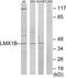 LIM homeobox transcription factor 1-beta antibody, TA314159, Origene, Western Blot image 