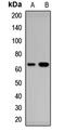 Arginyl-TRNA Synthetase 2, Mitochondrial antibody, LS-C668966, Lifespan Biosciences, Western Blot image 