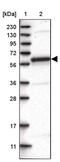 FA Core Complex Associated Protein 100 antibody, PA5-54939, Invitrogen Antibodies, Western Blot image 
