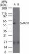 HsMAD2 antibody, TA336363, Origene, Western Blot image 