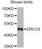 ERCC Excision Repair 8, CSA Ubiquitin Ligase Complex Subunit antibody, A6884, ABclonal Technology, Western Blot image 