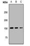 Ubiquitously Transcribed Tetratricopeptide Repeat Containing, Y-Linked antibody, LS-C668125, Lifespan Biosciences, Western Blot image 