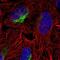 Zinc Finger CCHC-Type Containing 9 antibody, NBP2-57147, Novus Biologicals, Immunofluorescence image 