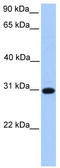 Electron transfer flavoprotein subunit beta antibody, TA334948, Origene, Western Blot image 