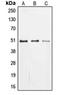 Early Growth Response 2 antibody, orb213880, Biorbyt, Western Blot image 