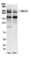 BRCA1 DNA Repair Associated antibody, A301-378A, Bethyl Labs, Western Blot image 