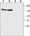 Solute Carrier Family 8 Member A1 antibody, TA328915, Origene, Western Blot image 