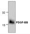 Platelet Derived Growth Factor Subunit B antibody, TA319091, Origene, Western Blot image 