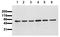 Akt antibody, AM00110PU-N, Origene, Western Blot image 