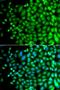 SPT20 Homolog, SAGA Complex Component antibody, LS-C349299, Lifespan Biosciences, Immunofluorescence image 