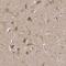 Leucine Zipper Protein 1 antibody, PA5-55883, Invitrogen Antibodies, Immunohistochemistry paraffin image 