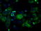 ATP Synthase F1 Subunit Beta antibody, TA500833, Origene, Immunofluorescence image 