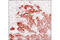Hepatocyte growth factor receptor antibody, 8198P, Cell Signaling Technology, Immunohistochemistry frozen image 
