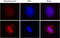 Acetylated-Lysine antibody, LS-C41115, Lifespan Biosciences, Immunocytochemistry image 