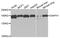 mDIA1 antibody, PA5-76822, Invitrogen Antibodies, Western Blot image 