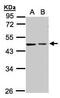 Galactokinase 2 antibody, PA5-34699, Invitrogen Antibodies, Western Blot image 