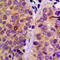 Phospholipase C Gamma 2 antibody, GTX32240, GeneTex, Immunohistochemistry paraffin image 