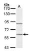 Nuclear receptor ROR-alpha antibody, GTX100029, GeneTex, Western Blot image 