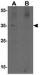 Protein kinase C delta-binding protein antibody, GTX31530, GeneTex, Western Blot image 