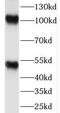 Nuclear Factor Kappa B Subunit 1 antibody, FNab05704, FineTest, Western Blot image 