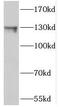 Nucleolar Protein 6 antibody, FNab05786, FineTest, Western Blot image 
