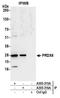 Peroxiredoxin 6 antibody, A305-315A, Bethyl Labs, Immunoprecipitation image 