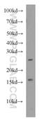 P53 And DNA Damage Regulated 1 antibody, 16968-1-AP, Proteintech Group, Western Blot image 